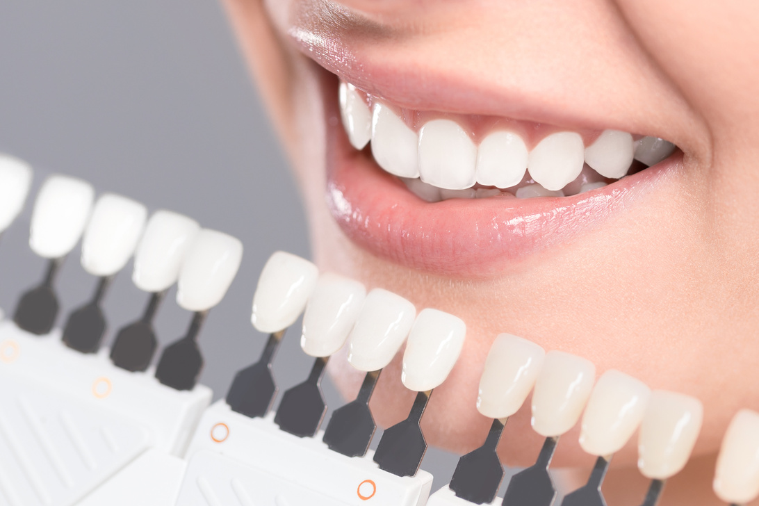 Beautiful Smile and White Teeth of a Young Woman